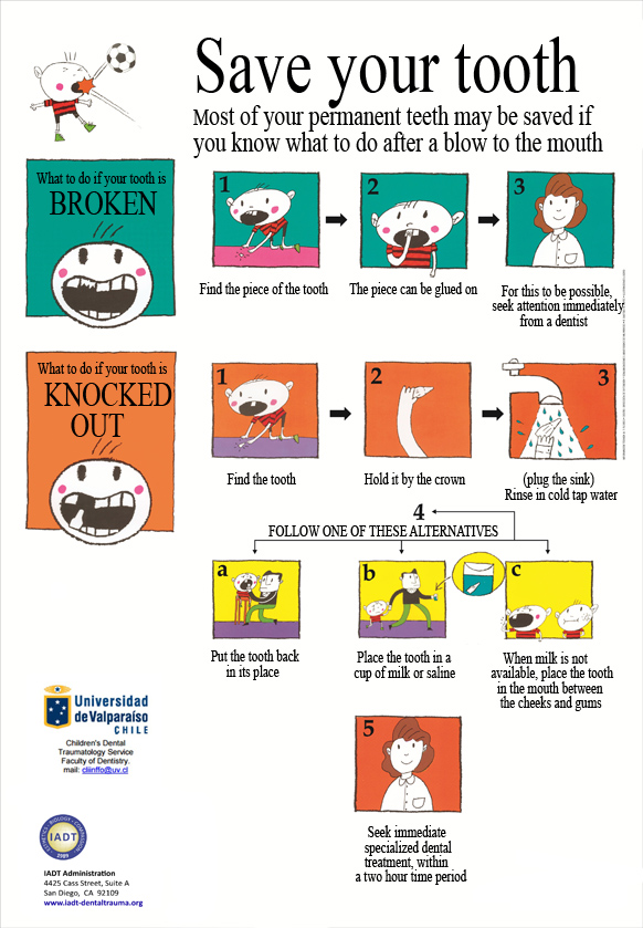 Save your tooth